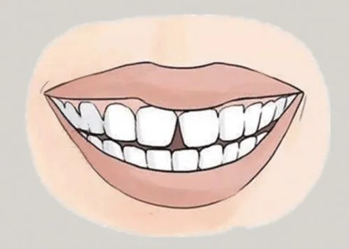 <a href=http://m.gzzkj.cn/news_article?news_id=116>一次性口腔探針</a>